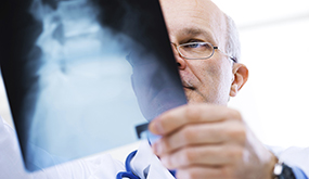 a physician looking at an x-ray slide